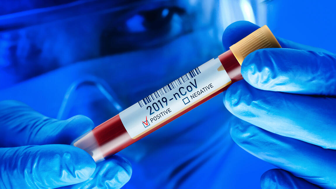 Daha bir futbolçuda koronavirus tapıldı