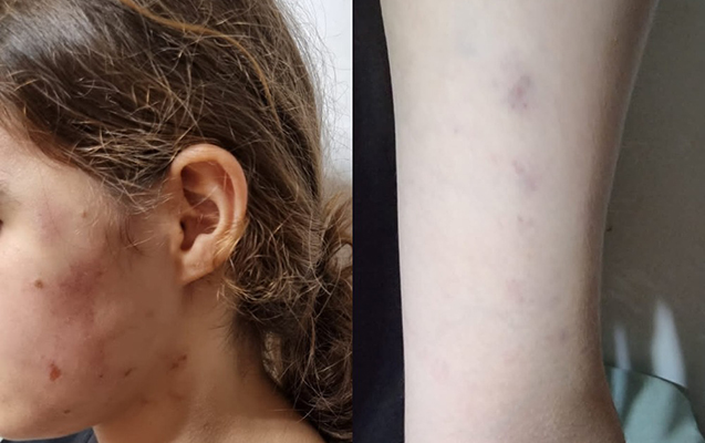 Azərbaycanda icra başçısının müavini məktəbli qızı döydü - Cinayət işi başlanıldı