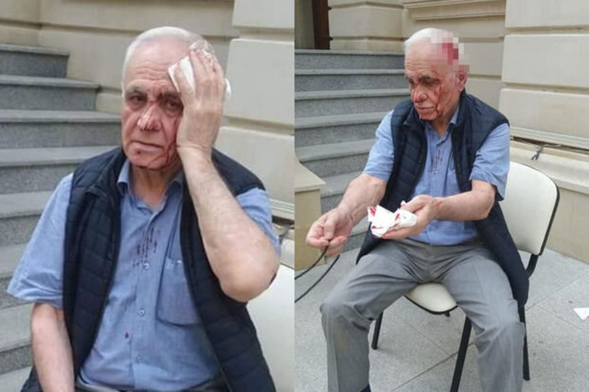 Rəhim Qazıyevə xəsarət yetirən şəxsin kimliyi bəlli oldu