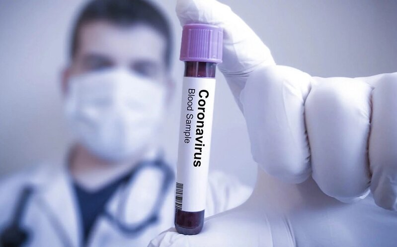 Azərbaycanda koronavirusa yoluxanların bu günə olan statistikası