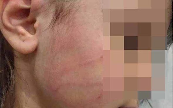 Mətanət İsgəndərlinin oğlu qızına işgəncə verib? - FOTO