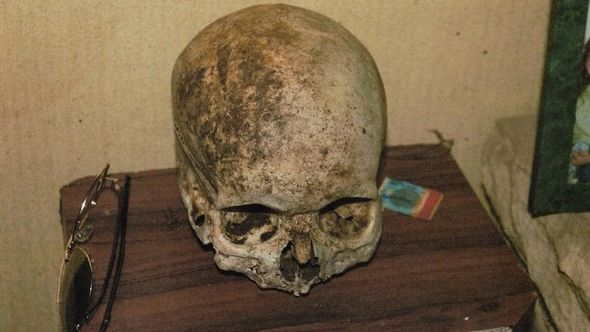 Bəzək əşyası kimi istifadə etdiyi əşya itkin düşmüş şəxsin kəllə sümüyü çıxdı - FOTO
