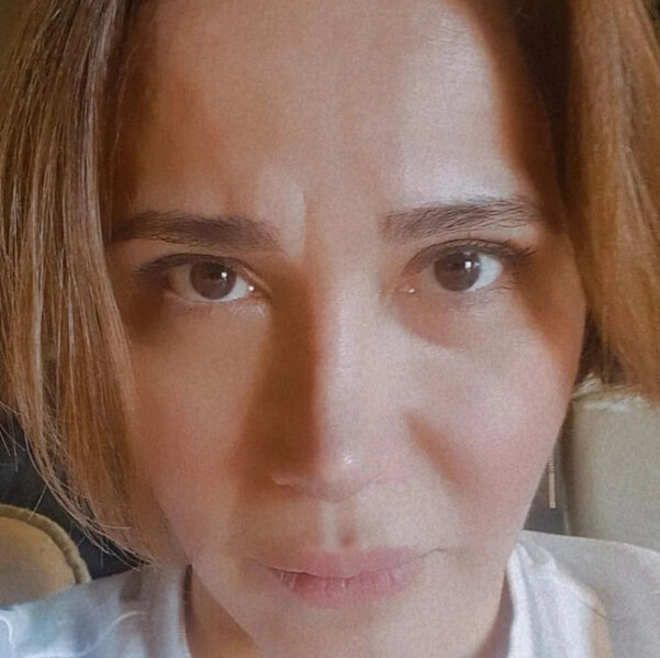 Xalq artistinin dəhşətli qəzadan sonra ilk görüntüsü - FOTO