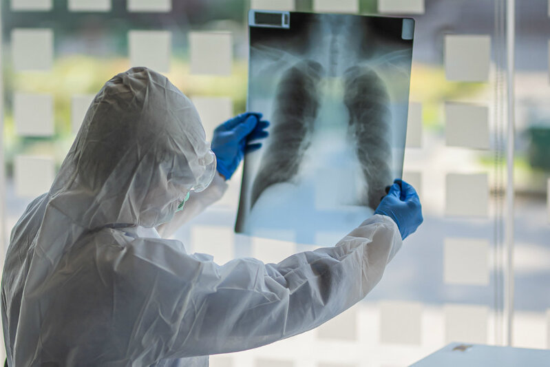 Buzlu şüşə diaqnozu qoyulan koronavirus xəstələri nə etməlidirlər? - Həkimdən AÇIQLAMA