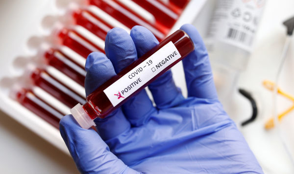 DİN: "21 nəfər aktiv koronavirus xəstəsi ictimai yerlərdə saxlanılaraq evə qaytarılıb