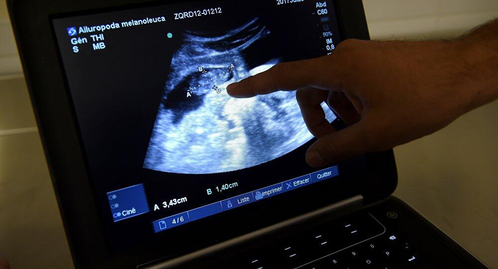Abortla bağlı ŞOK QƏRAR