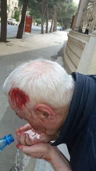 Rəhim Qazıyevin döyülməsi ilə bağlı cinayət işi başladılıb - FOTO