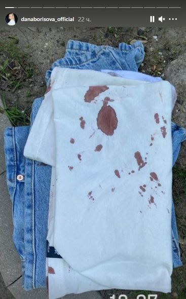 Rusiyada məşhur aparıcının qızı özünü doğrayıb - FOTO/VİDEO
