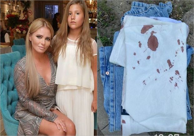 Rusiyada məşhur aparıcının qızı özünü doğrayıb - FOTO/VİDEO