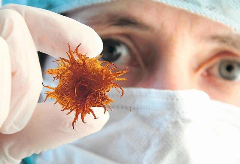 Xərçəng riskini azaldan orqan - Alimlərdən yeni kəşf