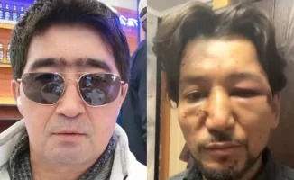 Qazaxıstanda musiqiçilər arasında dava düşdü - Müğənninin burnu sındı