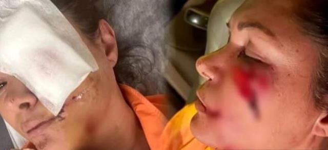 Tanınmış model itin hücumuna məruz qaldı: Son halı görənləri kədərləndirdi