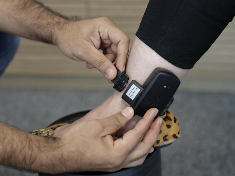 Azərbaycanda ginekoloqa elektron qolbaq taxıldı