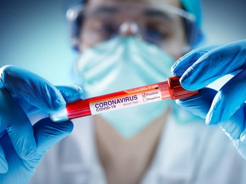 Azərbaycanda koronavirusa yoluxanların bu günə olan statistikası