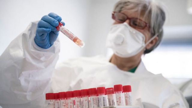 Azərbaycanda koronavirusa yoluxanların bu günə olan statistikası