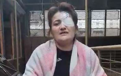 Gəncədə evi dağılan qadın şikayətçidir: İcra Hakimiyyətindən AÇIQLAMA - FOTO