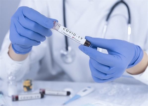 Azərbaycanda daha səkkiz nəfər koronavirusdan öldü: 321 yeni yoluxma - FOTO