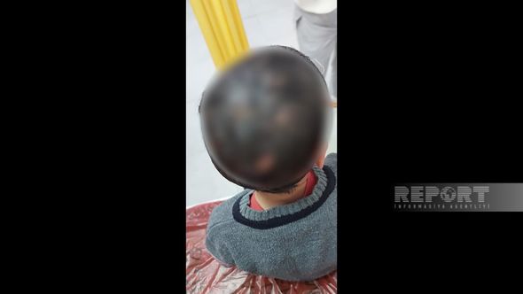 Masazırda azyaşlılar itlərin hücumuna məruz qalıblar - FOTO