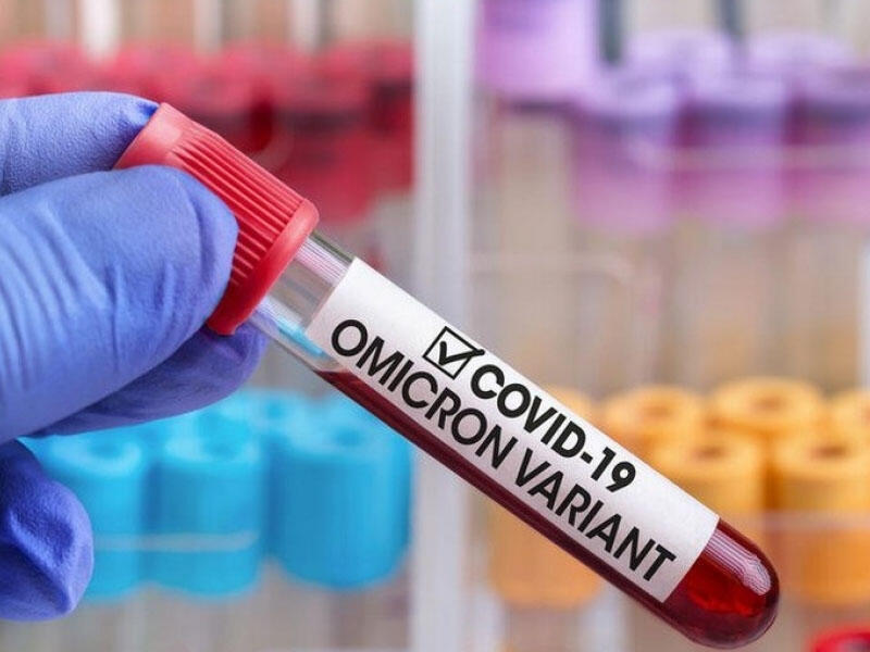 Azərbaycanda daha 12 nəfər koronavirusdan vəfat etdi