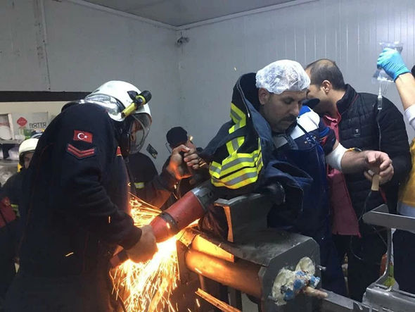 Ani diqqətsizlik nəticəsində qolundan olacaqdı - FOTO