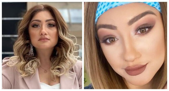 Zümrüd Bədəlova qulağını, qaşlarını və gözünü estetik əməliyyat etdirdi - YENİ GÖRÜNTÜLƏRİ