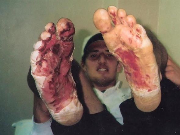 10 dəfə ölümdən xilas olan dünyanın ən bəxtəvər insanı - FOTO/VİDEO