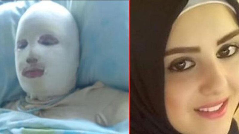 Kişi hamilə arvadını yandırdı - FOTO