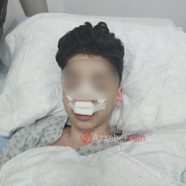 Bakıda şagird məktəbdə döyüldü - DİN-dən açıqlama