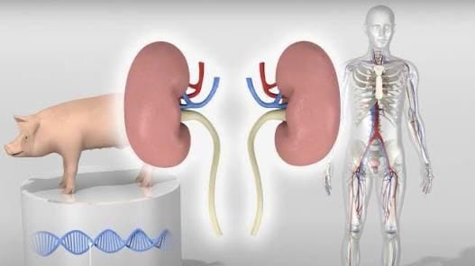 Yaponiyada 2028-ci ildən insanlara donuz böyrəyi köçürüləcək