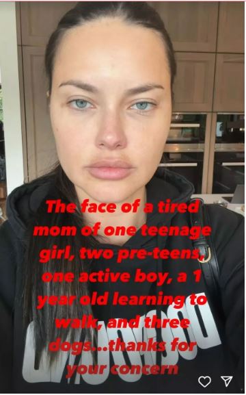 Adriana Lima onu tənqid edənlərə belə cavab verdi - FOTO