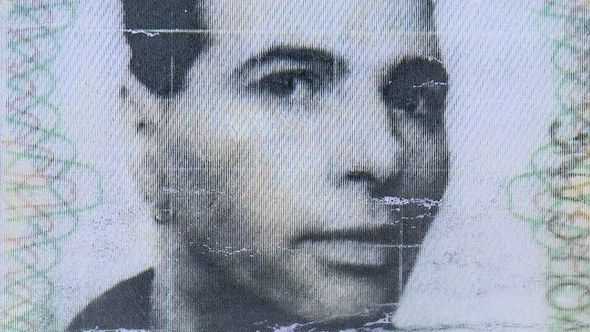 Bədəninin 98 faizi döymə olan təqaüdçü – FOTO