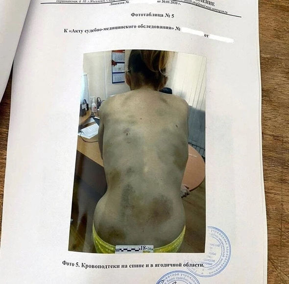 Boşanmaq istəyən arvadını evə bağlayıb, bir ay ac saxladı - FOTO/VİDEO