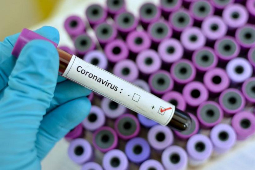 18 məhkumda koronavirus aşkarlanıb
