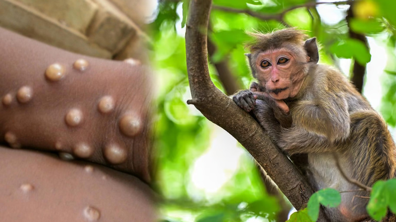 Dünyanı yeni virus çalxalayır: Azərbaycanda da yayılacaq? - XƏBƏRDARLIQ