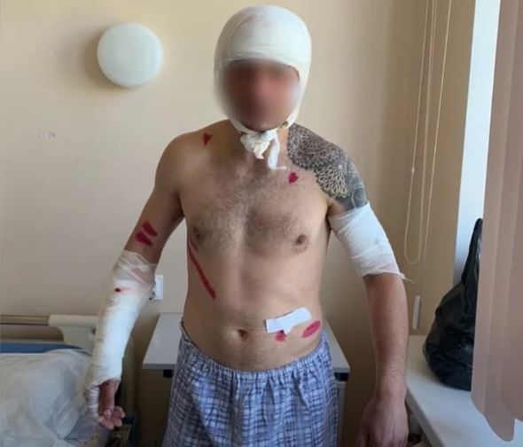 Özünü ölülüyə vurmaqla ayının pəncəsindən xilas oldu - FOTO