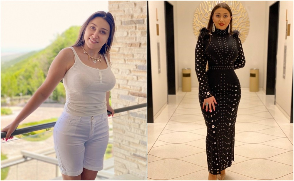 Damla plastik əməliyyat etdirib? - Foto