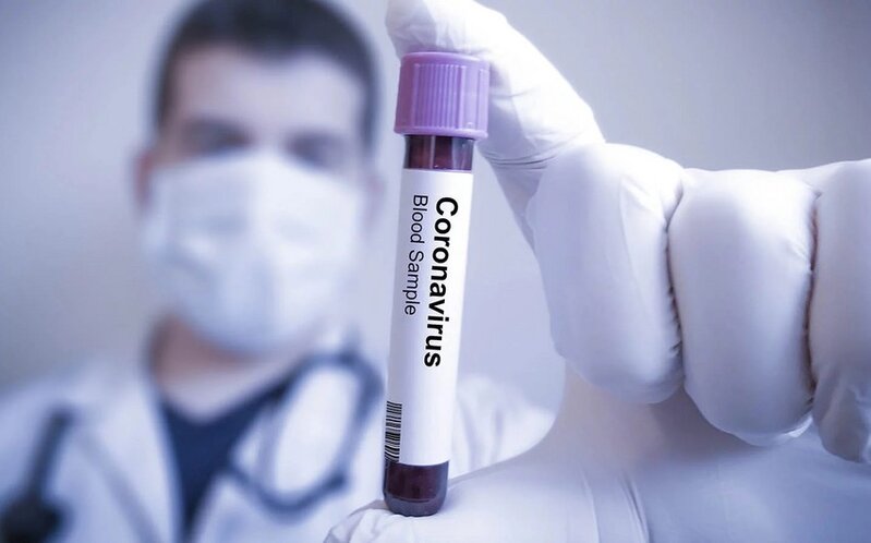 Azərbaycanda daha 53 nəfər koronavirusa yoluxdu