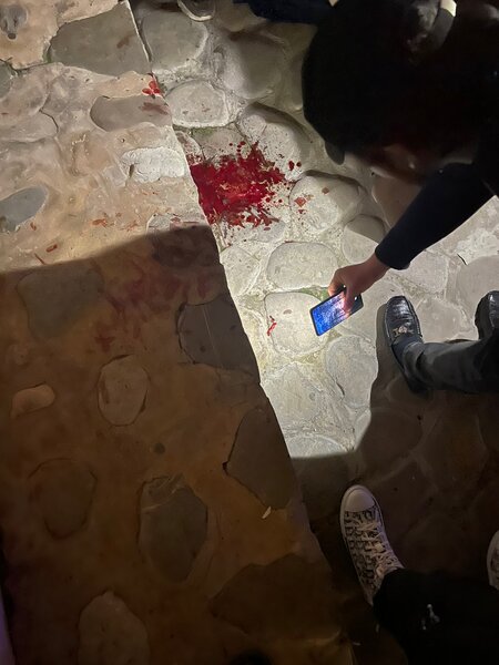 Gənc oğlan Bulvarda özünü doğradı - FOTO