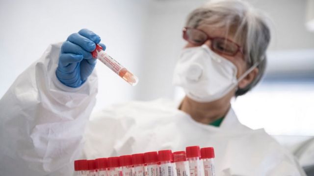 Azərbaycanda koronavirusa yoluxanların sayı artdı