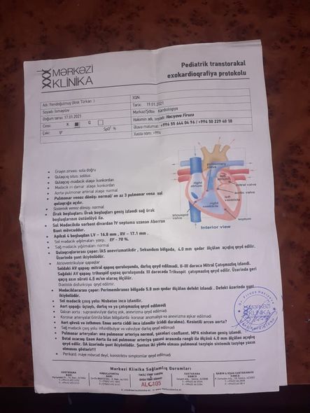 Körpə Əlinin sağlamlığına qovuşmasına kömək edək - FOTO