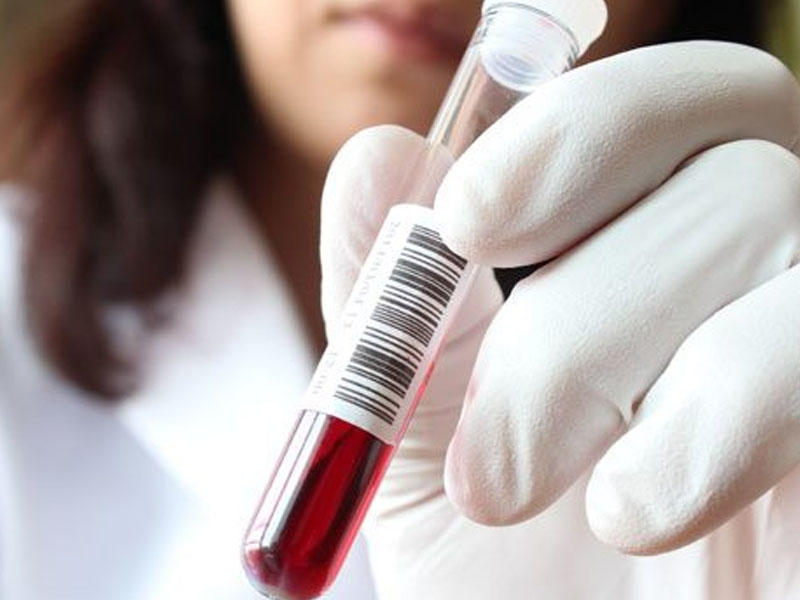 ÜST yeni koronavirus səbəbi ilə təcili iclas çağırır