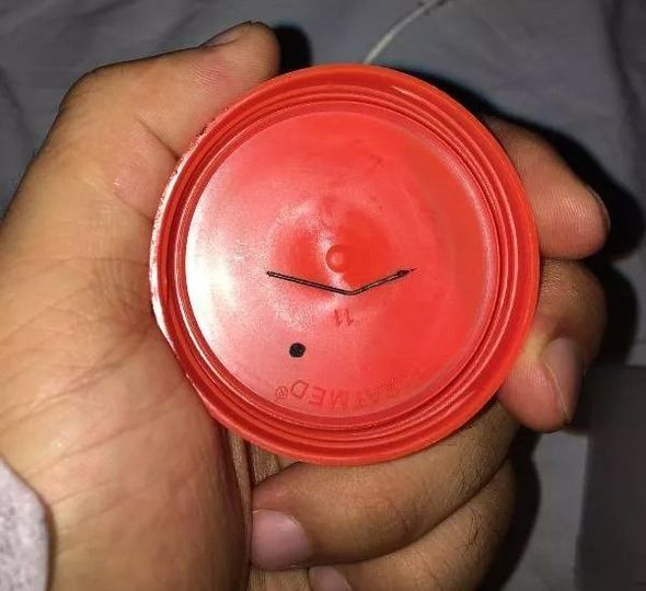 Dostunun ad günündə yediyi tort boğazında ömürlük iz qoydu - FOTO