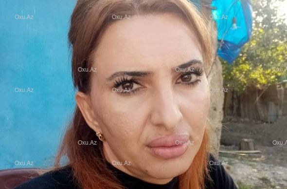 Bərdədə dodaqlarına dolğu vurduran qadının başına iş gəlib 