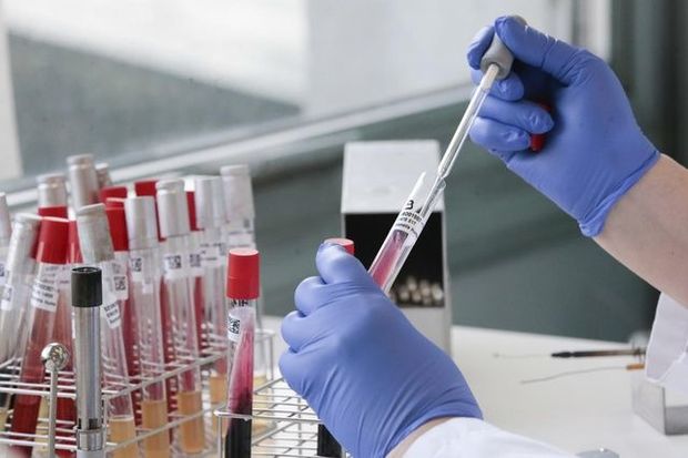 Deputatdan TƏKLİF: Koronavirus testlərinin qiyməti endirilsin