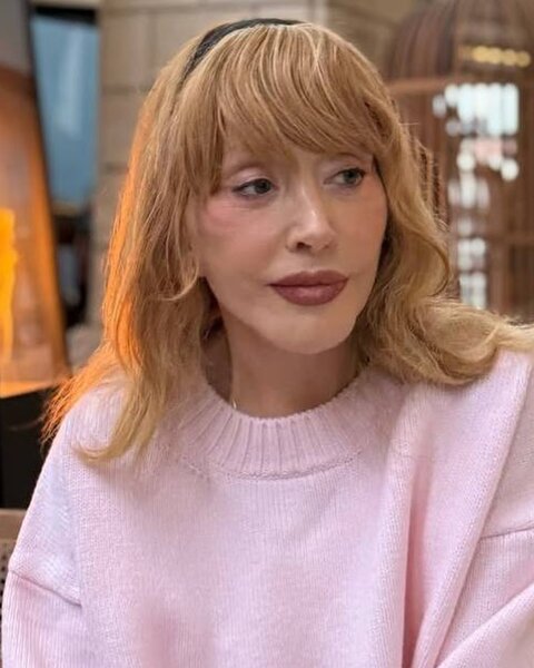 Alla Puqaçova tanınmaz halda - FOTOLAR