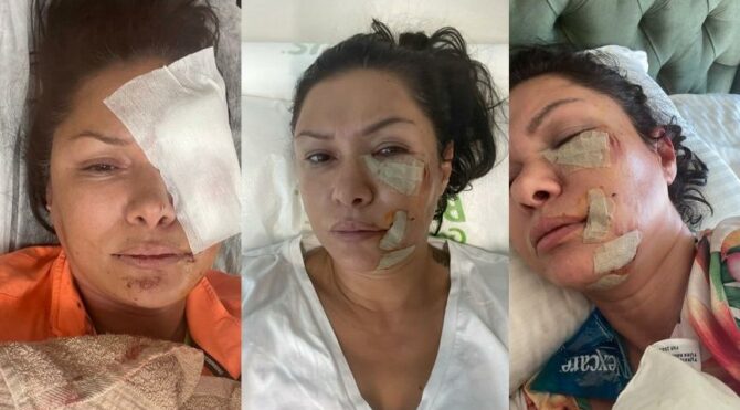 Tanınmış model itin hücumuna məruz qaldı: Son halı görənləri kədərləndirdi