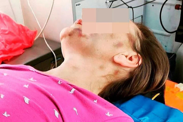 Boşanmaq istəyən arvadını evə bağlayıb, bir ay ac saxladı - FOTO/VİDEO
