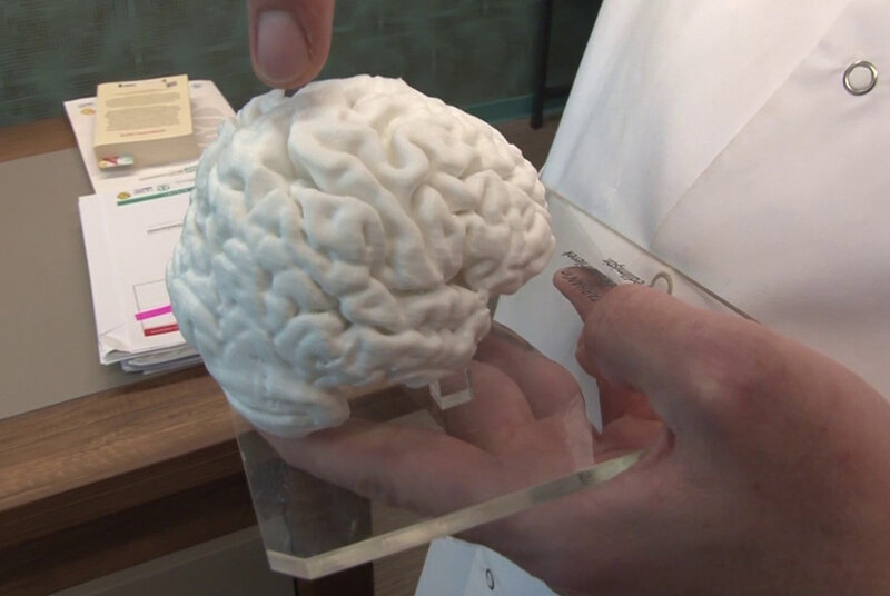 Türkiyədə bir ilk: 3D printerlə insan beyninin nüsxəsi hazırlandı - VİDEO