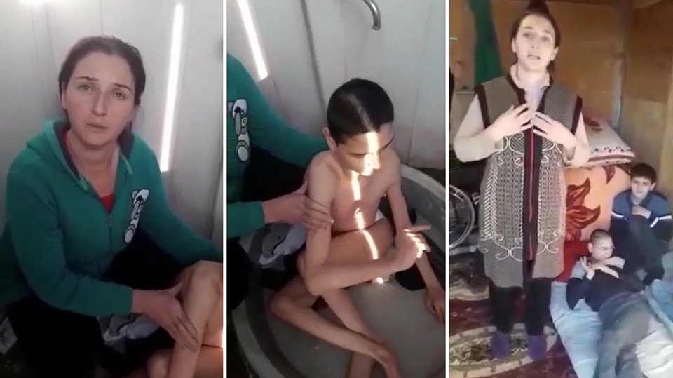 İbayevlər ailəsi xəstə övladları üçün kömək istəyir - FOTO/VİDEO