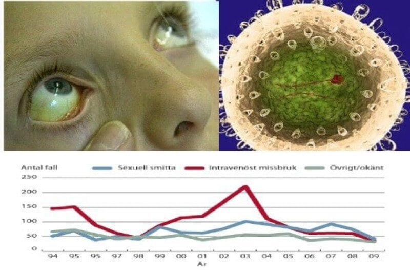 Hepatit A virusunu necə tanımalı? - Hepatoloq açıqladı - MÜSAHİBƏ + FOTO